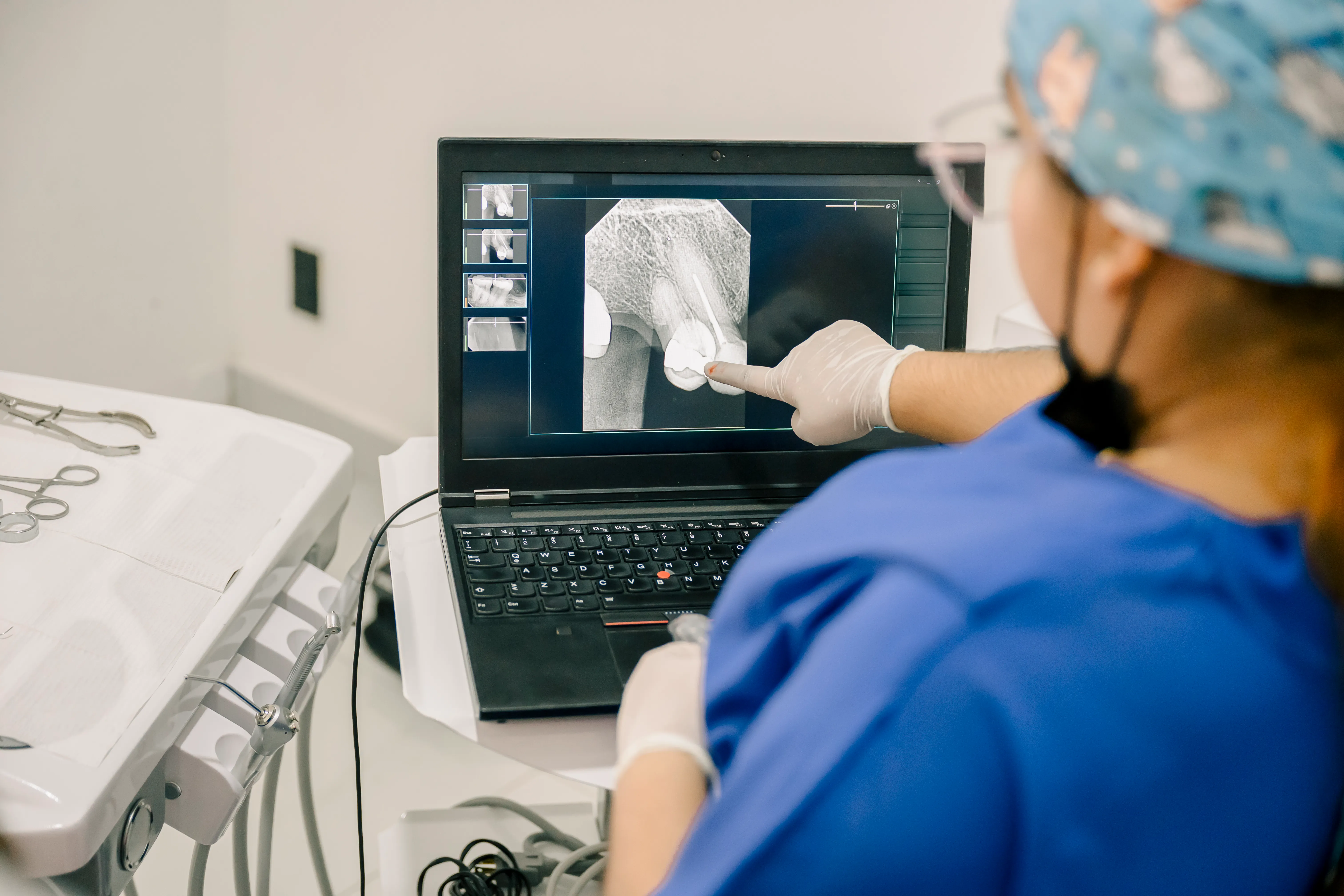  Equipo realizando una radiografía digital periapical dental con sensor intraoral para obtener imágenes rápidas, claras y seguras en diagnóstico odontológico. 